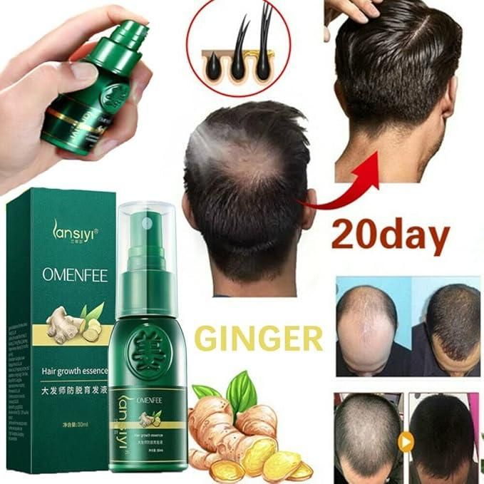 Japanese hair Growth Spray 100ml (Pack of 2) 30%OFF